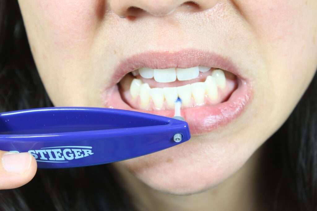 Nettoyage interdentaire frontale grâce la la brossete interdentaire Circum 3 qui est inséré dans le manche de la brosse à dents Dr.stiger bleu